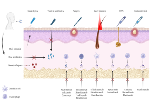 This medical illustration details various dermatological treatments and their specific mechanisms of action across the different layers of the skin and the immune system. The diagram showcases a spectrum of therapeutic options ranging from superficial interventions like keratolytics, topical antibiotics, and laser therapy to surgical procedures and systemic treatments such as oral antibiotics and hormonal agents. Furthermore, it highlights the role of biologics (e.g., Adalimumab, Secukinumab) in blocking specific inflammatory pathways by interacting with dendritic cells, macrophages, and cytokines to manage underlying skin conditions.  Would you like